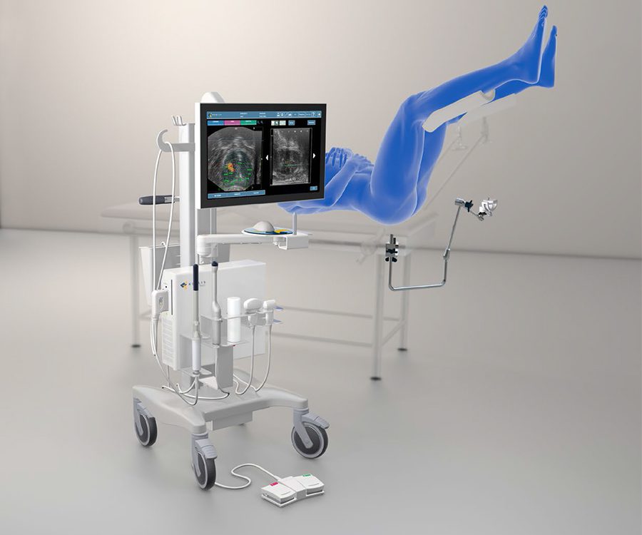 biopsja fuzyjna na aparacie Koelis Trinity