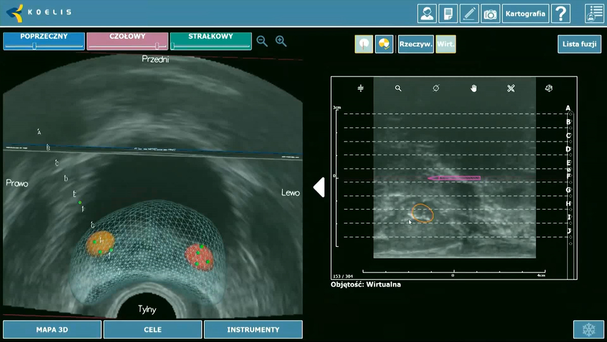 bfp_mapping_platu