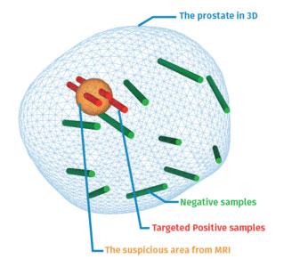 biopsja-7