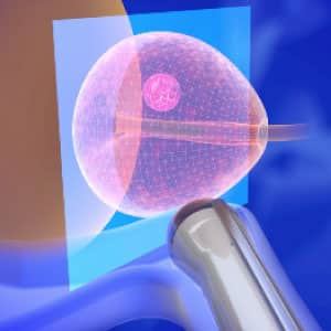 biopsja_procedura-2