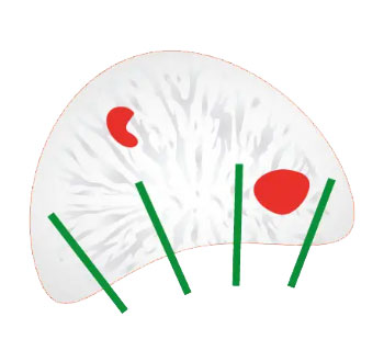 biopsja_standardowa-1