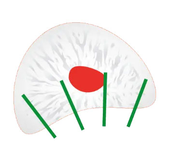 biopsja_standardowa-3