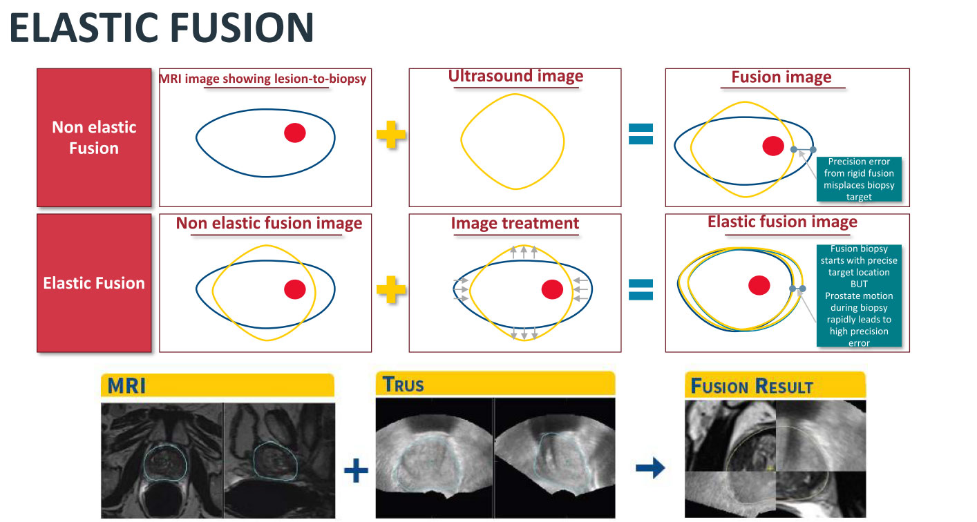 elastic_fusion