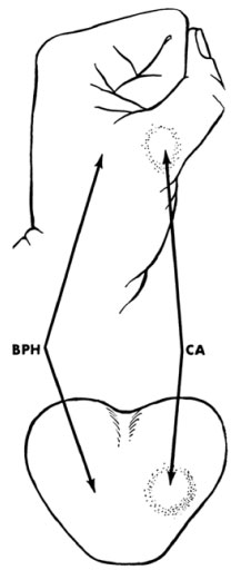 genezja_biopsji_prostaty-2