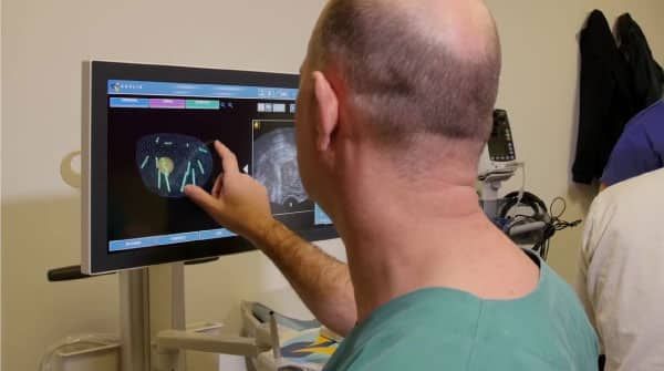 Przezodbytnicza biopsja prostaty - analiza biopsji na monitorze Koelis
