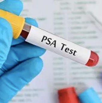 próbka testu PSA