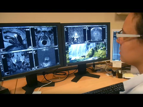 lekarz obserwujący biopsję na monitorze komputera
